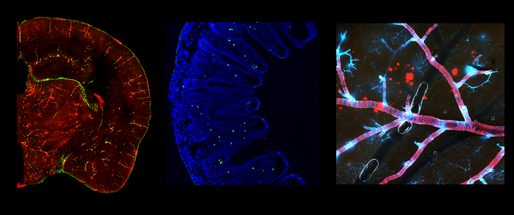 sections of brain with fluorescent dye