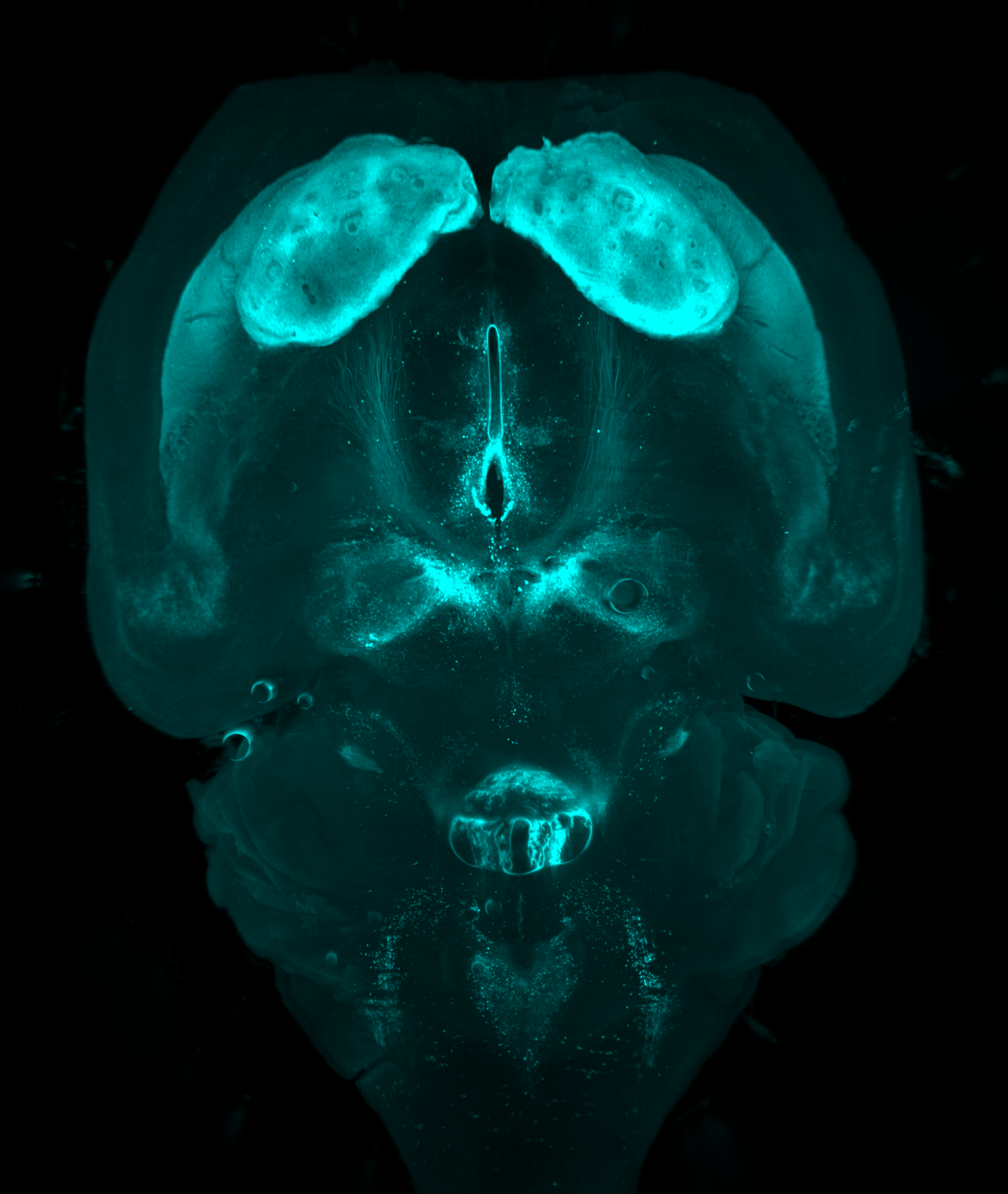 Scan of mouse brain